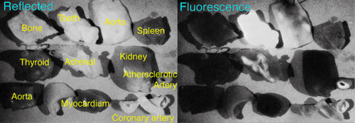 Infrared luminescence of tissue specimens